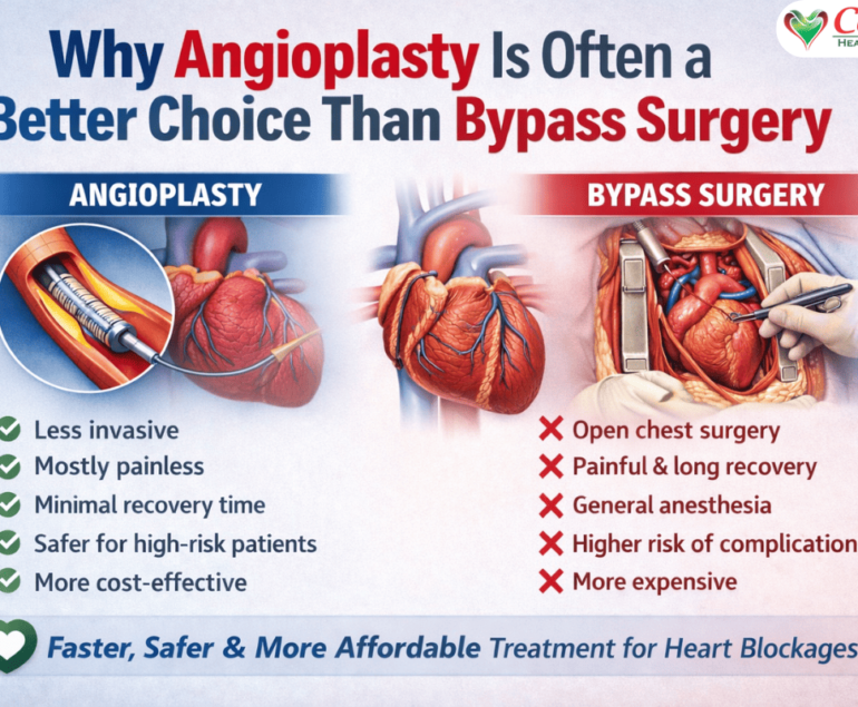 why angioplasty is better than bypass surgery
