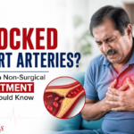 blocked heart arteries treatment without surgery