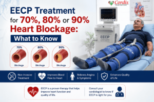 EECP treatment for 70%, 80% or 90% heart blockage