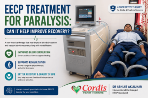 EECP treatment for paralysis recovery using enhanced external counterpulsation therapy