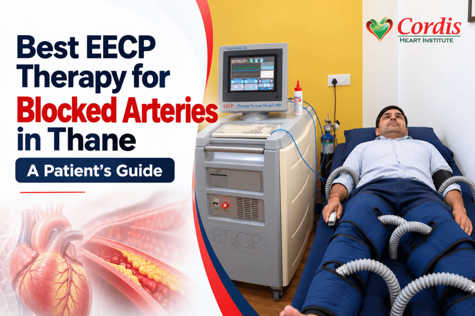 EECP therapy for blocked arteries in Thane